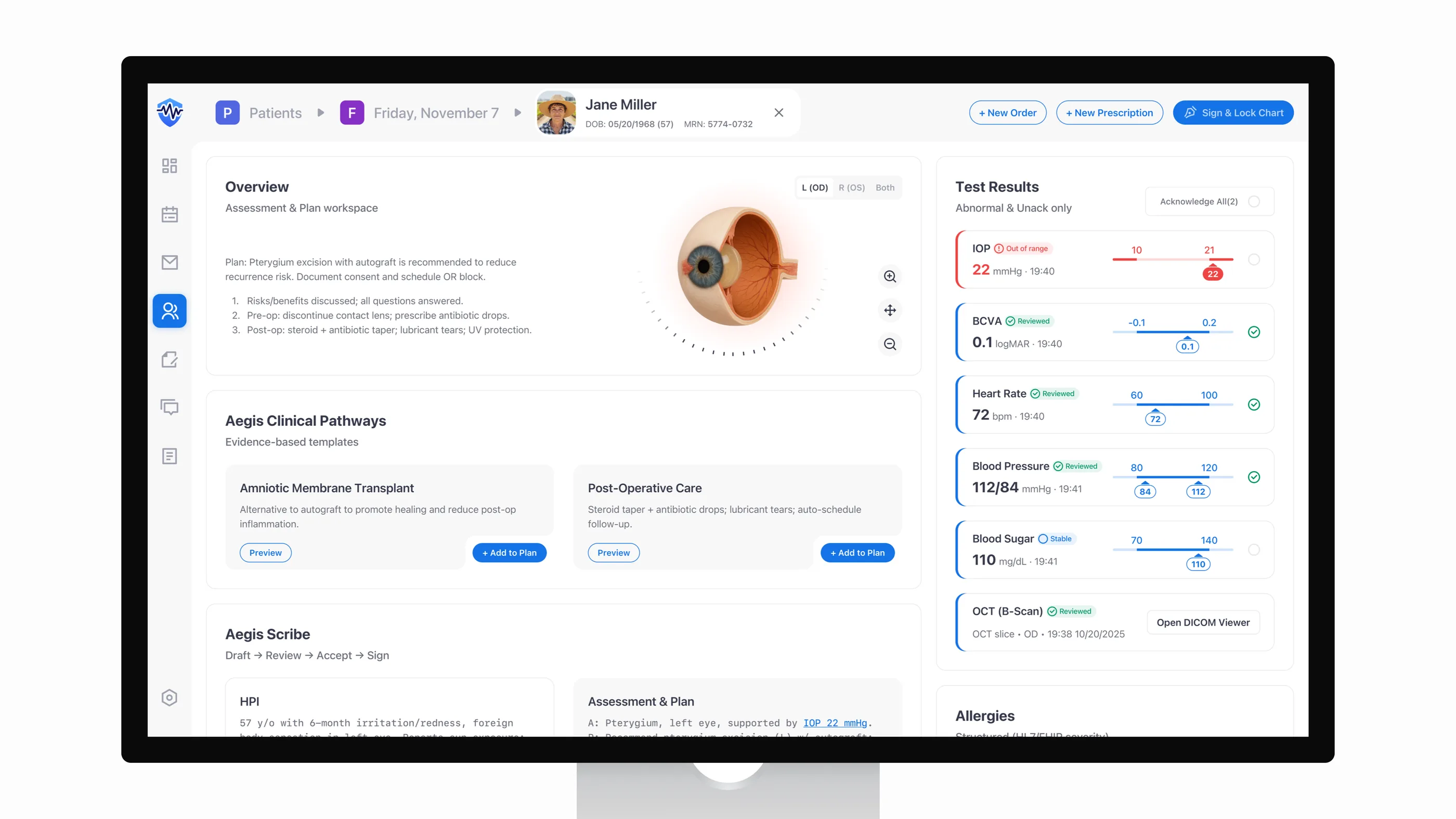 Aegis V2 overview composite showing identity banner, Action↔Data layout, structured allergies, results queue, and AI Scribe