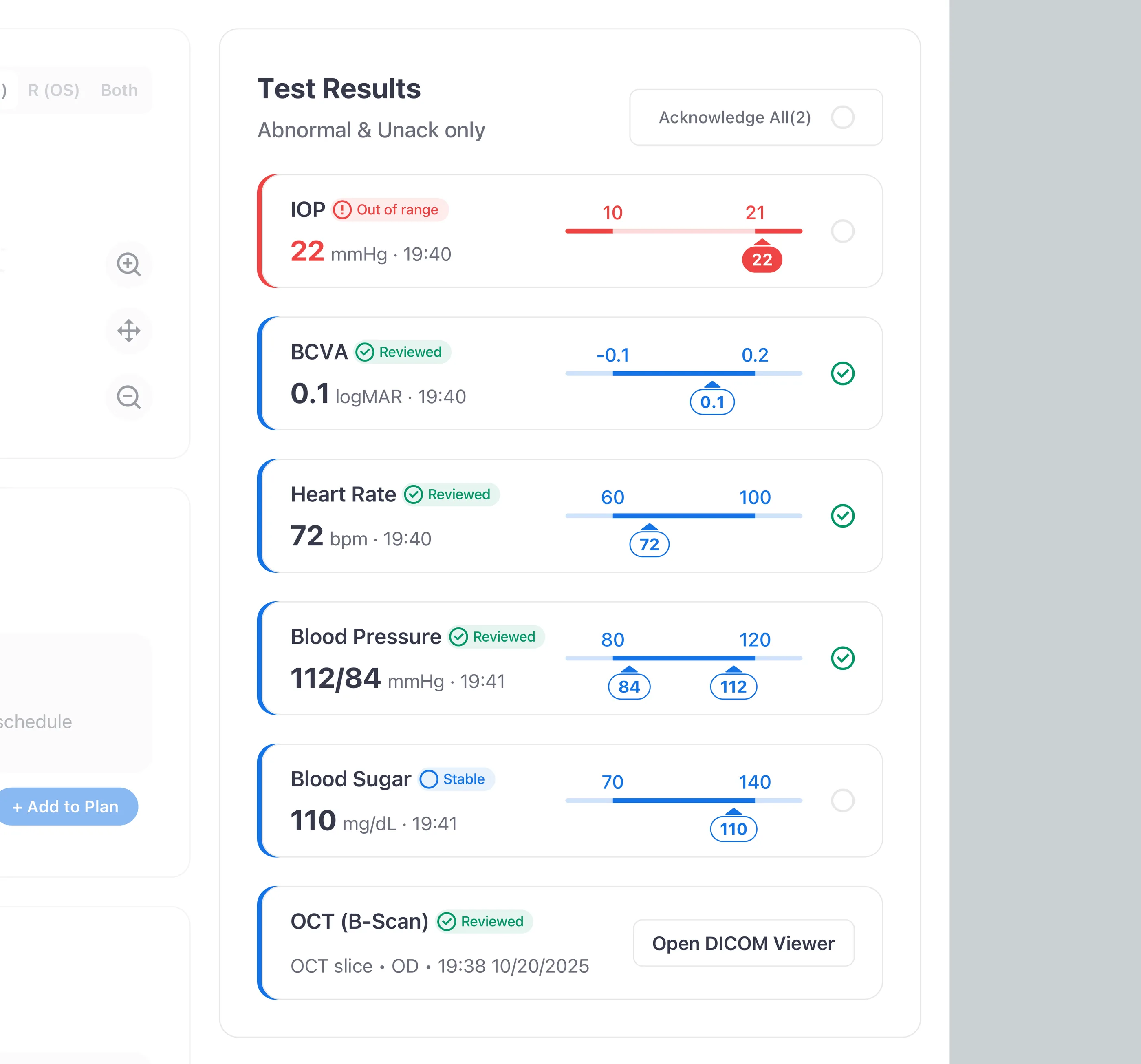 Results queue with New, Critical, and Acknowledge controls; each row shows acknowledgement state and signing actor