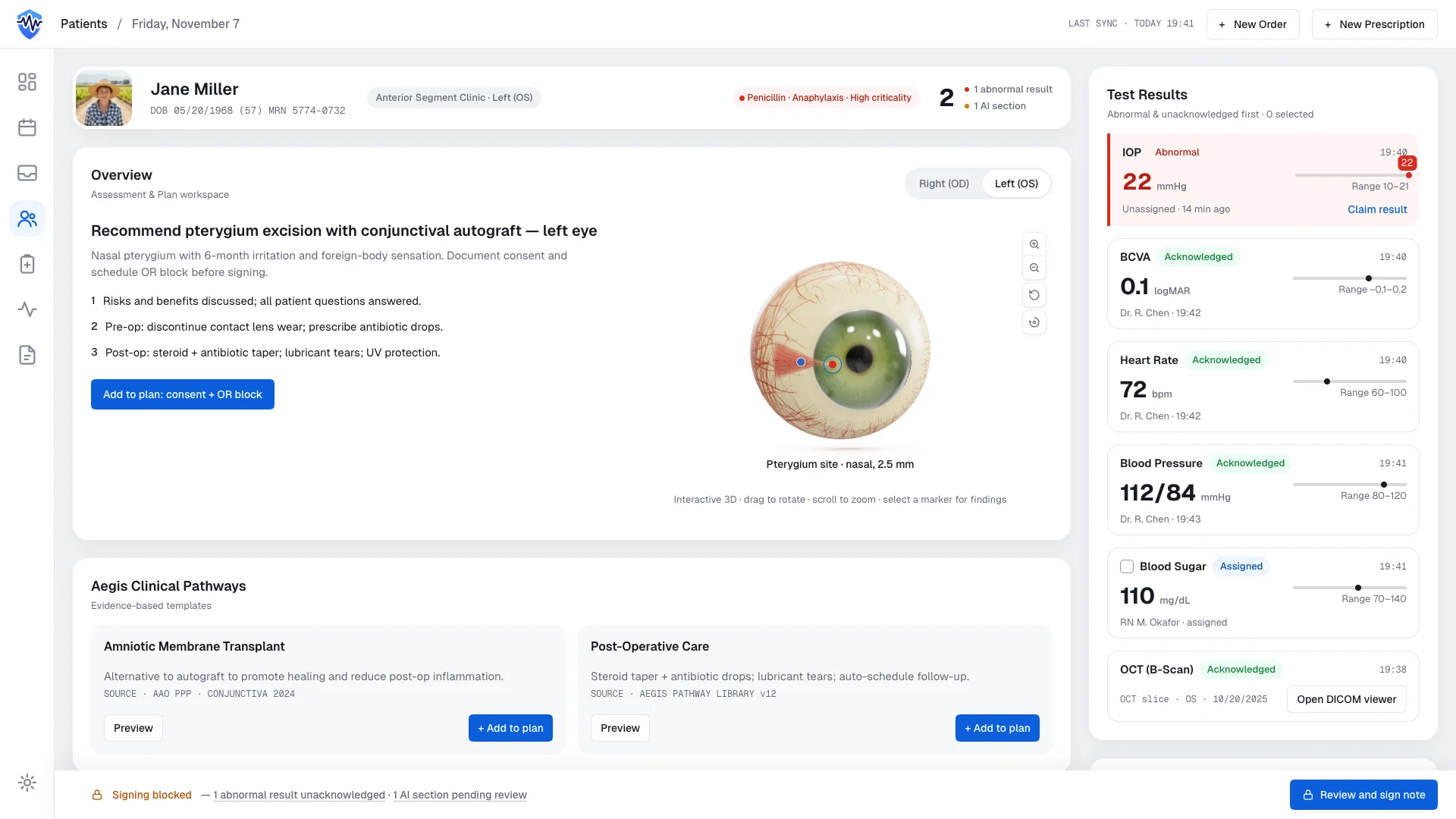 Aegis clinical workstation demo: patient header with allergy chain, laterality tabs, procedural 3D eye, test results queue, and a sign gate footer